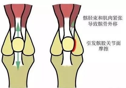 且行且珍“膝”