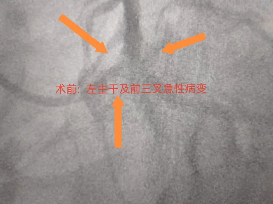 術前.jpg 術前.jpg