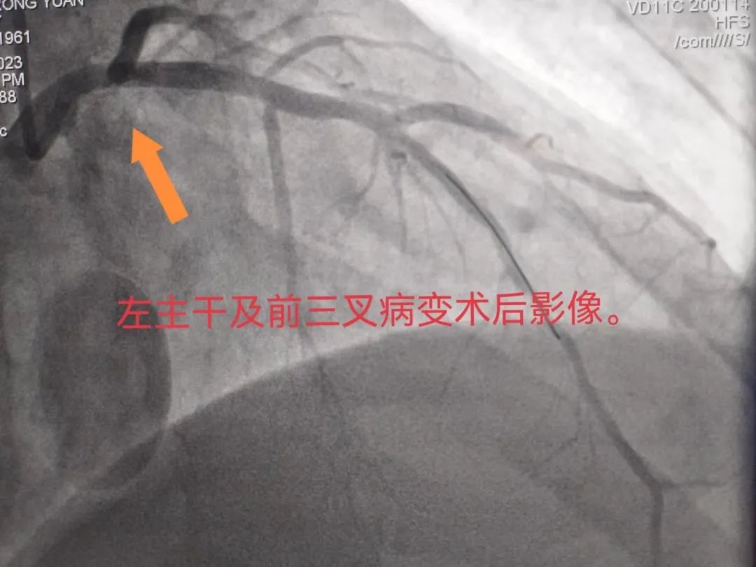 術后.jpg 術后.jpg