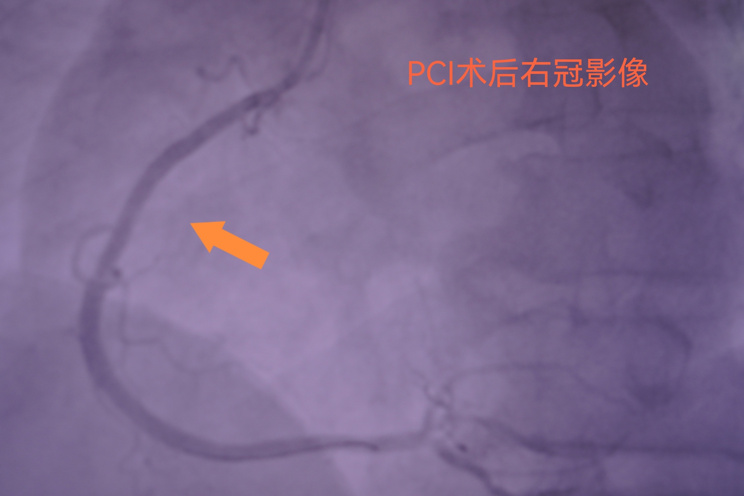 微信圖片_20240325090331.jpg 微信圖片_20240325090331.jpg