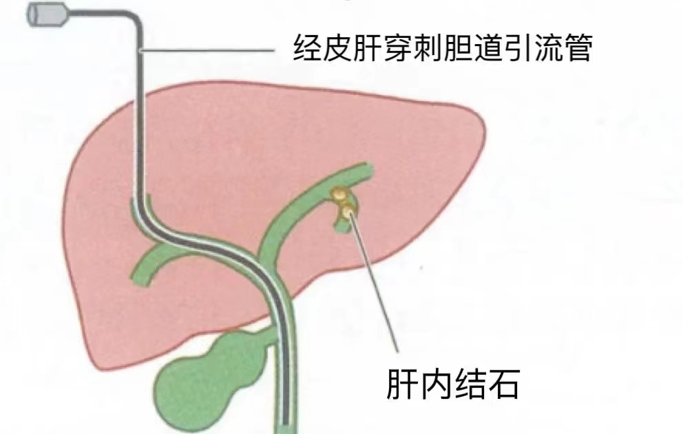 微信圖片_20240530151816.jpg 微信圖片_20240530151816.jpg