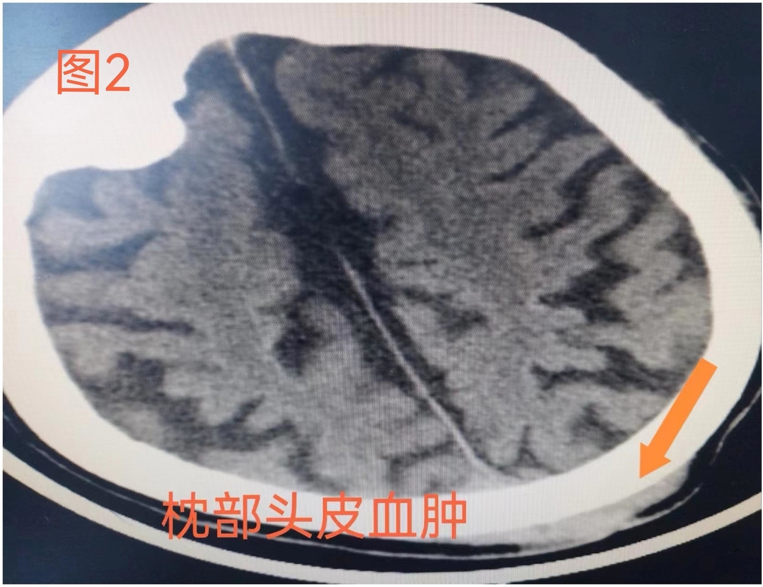 微信圖片_20240726102513 - 副本.jpg 微信圖片_20240726102513 - 副本.jpg